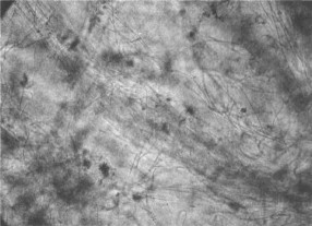 MBR污泥膨脹怎么處理？污泥膨脹的處理方法(圖2)